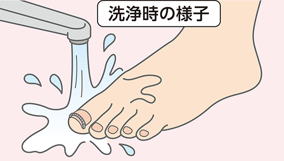 洗浄時の様子